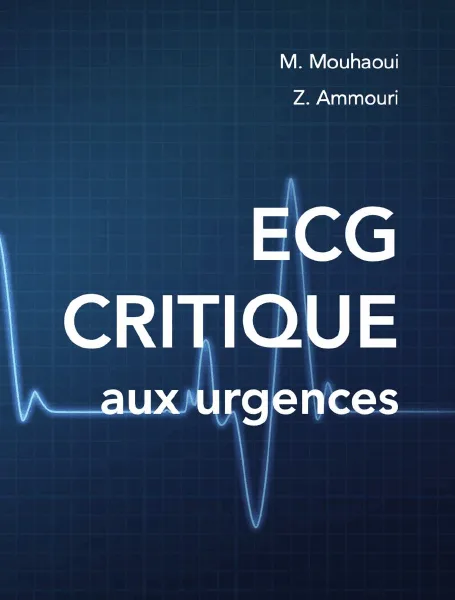 Cardiologie ECG CRITIQUE