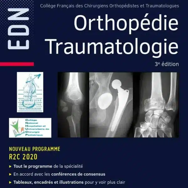 College OrthopedieTraumatologie 3eme edition
