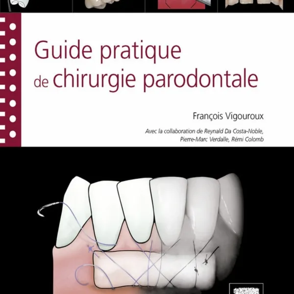 Guide pratique de la chirurgie parodontale