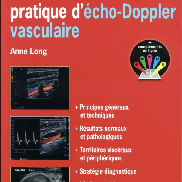 Guide pratique d'echo-doppler vasculaire