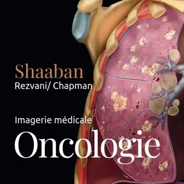 Imagerie medicale : Oncologie