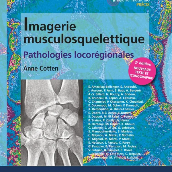 Imagerie musculosquelettique : pathologies locoregionales: Patho Locoregionales (2 TOME)