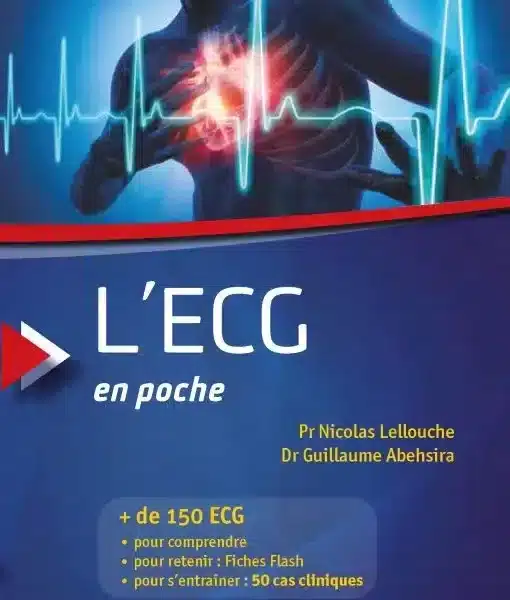 L'ECG en poche. 3e edition actualisee et augmentee