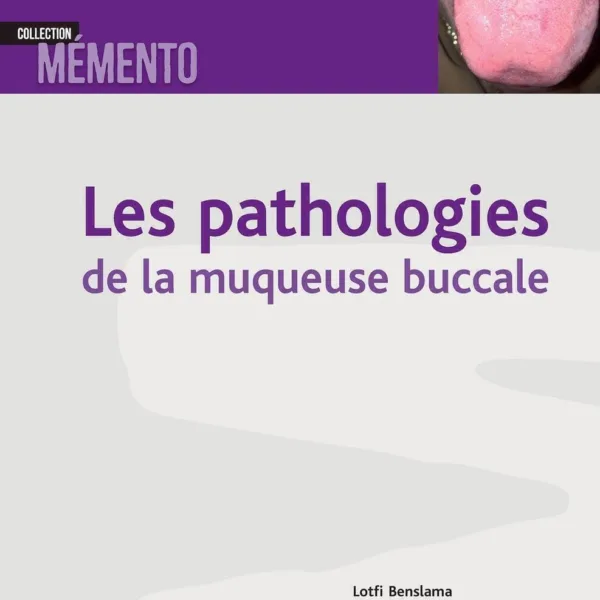 Les pathologies de la muqueuse buccale