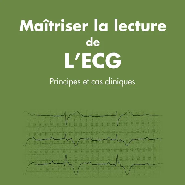 Maitriser la lecture de l'ECG - Principes et cas cliniques