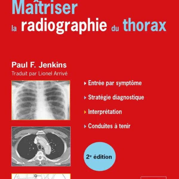 Maitriser la radiographie du thorax