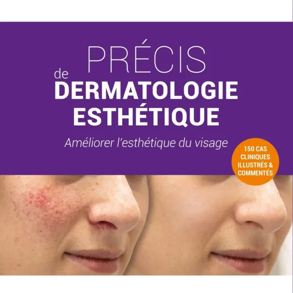 Precis de dermatologie esthetique