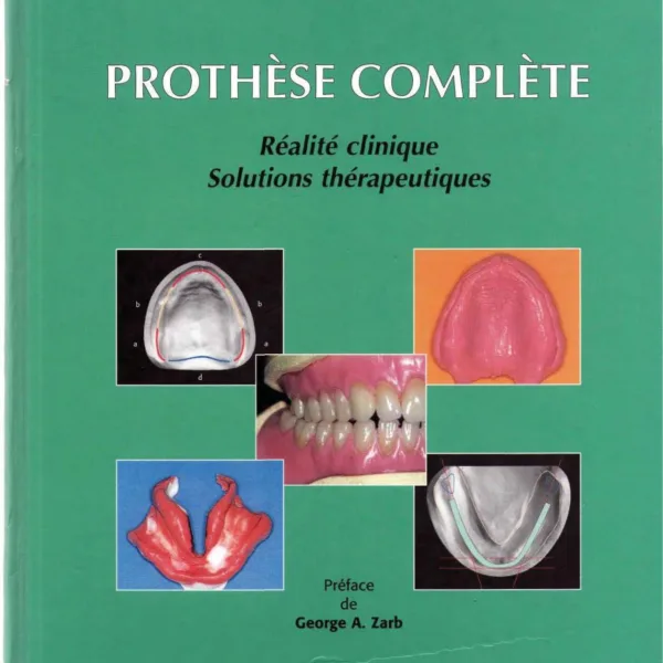 Prothèse complète : réalité clinique, solutions thérapeutiques