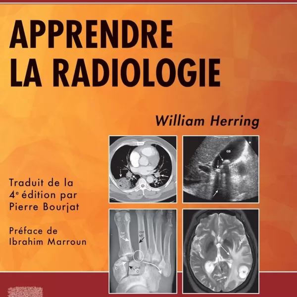 Apprendre la radiologie-Elsevier (2020) - William Herring