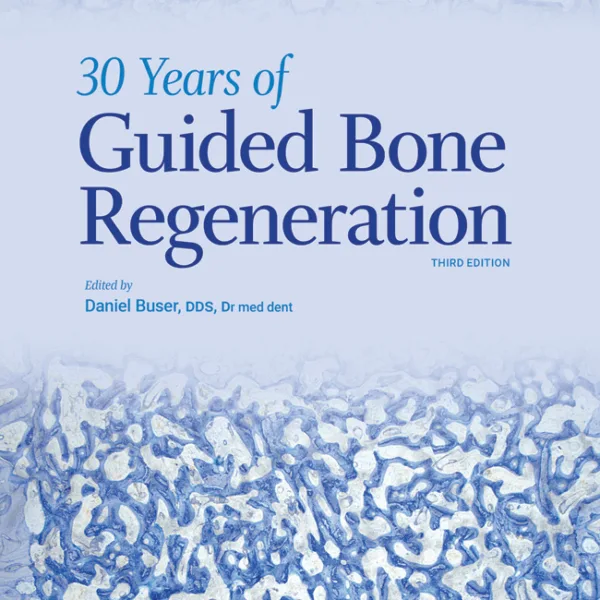 30 Years of Guided Bone Regeneration