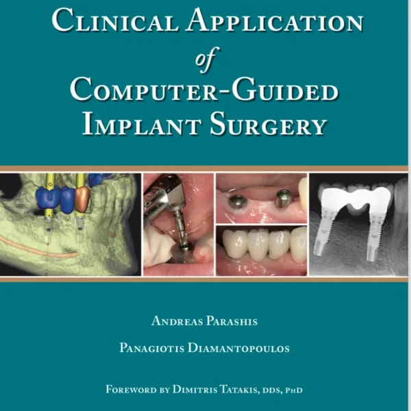 Clinical Application of Computer-Guided Implant Surgery