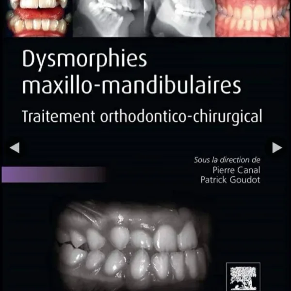 Dysmorphies maxillo-mandibulaires
