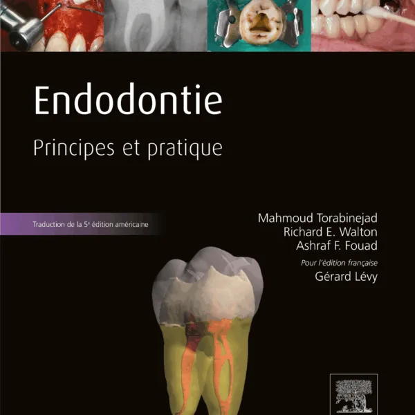 Endodontie Principe et pratique