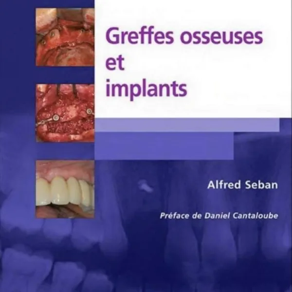 Greffes osseuses et implants