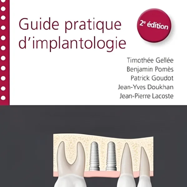 Guide pratique dimplantologie  2e edition