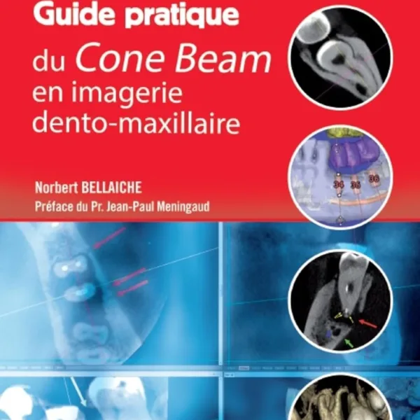 Guide pratique du Cone Beam en imagerie dento-maxillaire