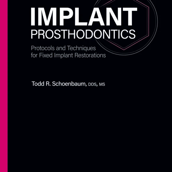 Implant Prosthodontics: Protocols and Techniques for Fixed Implant Restorations