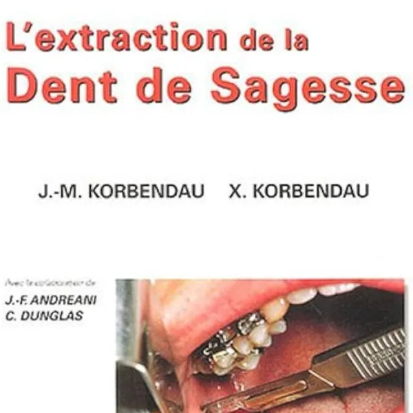Lextraction de la dent de sagesse