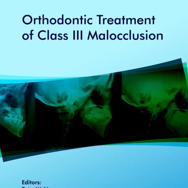 Orthodontic Treatment of Class III Malocclusion