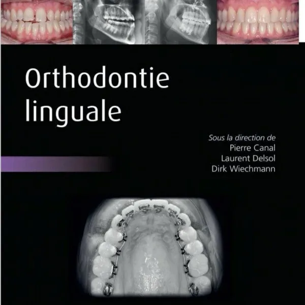 Orthodontie Linguale Edition: 1st Edition