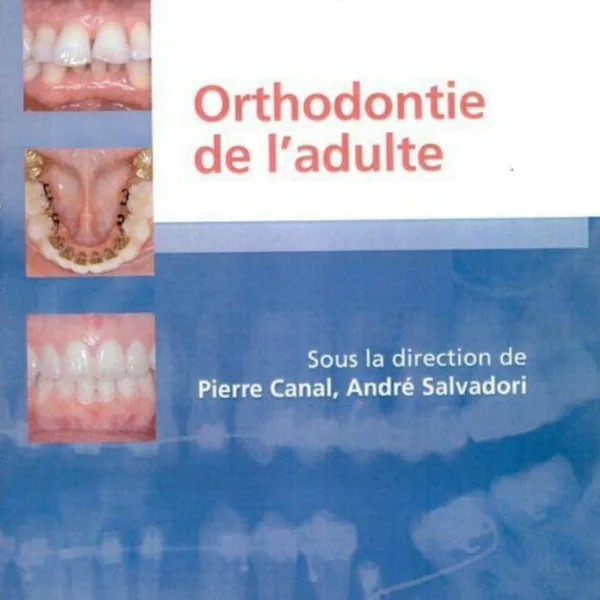 Orthodontie de ladulte