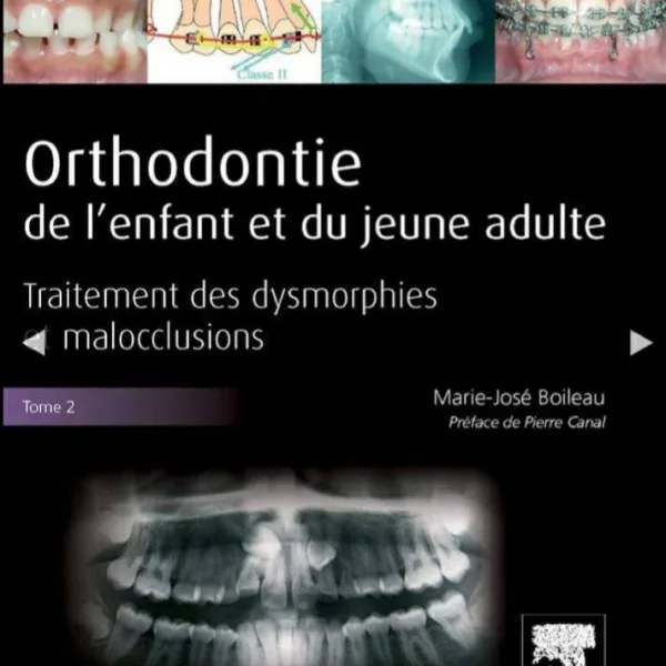 Orthodontie de lenfant et du jeune adulte T.2 : Traitement des dysmorphies et malocclusions