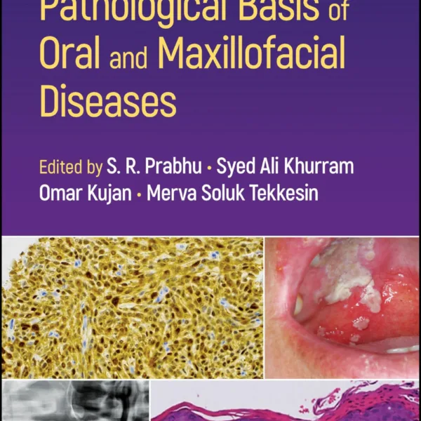 Pathological Basis of Oral and Maxillofacial Diseases