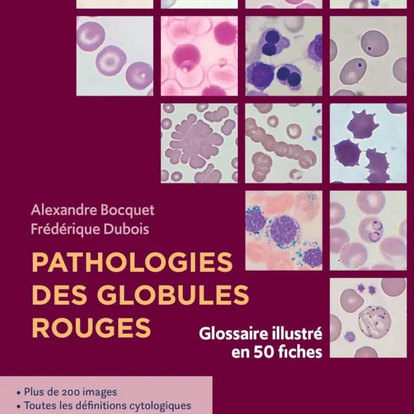 Pathologies des globules rouges: Glossaire illustre en 50 fiches