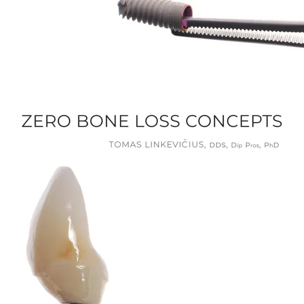 Zero Bone Loss Concepts