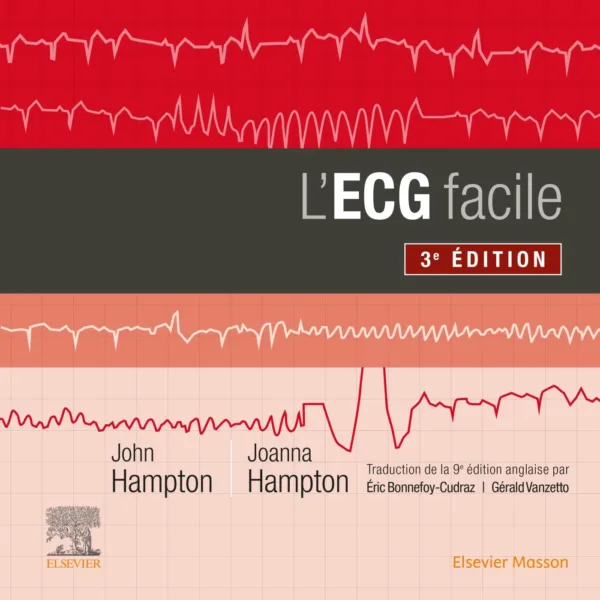 L'ECG facile 3é Édition