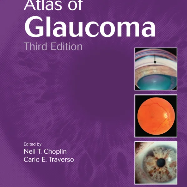 Atlas of Glaucoma 3rd Edition